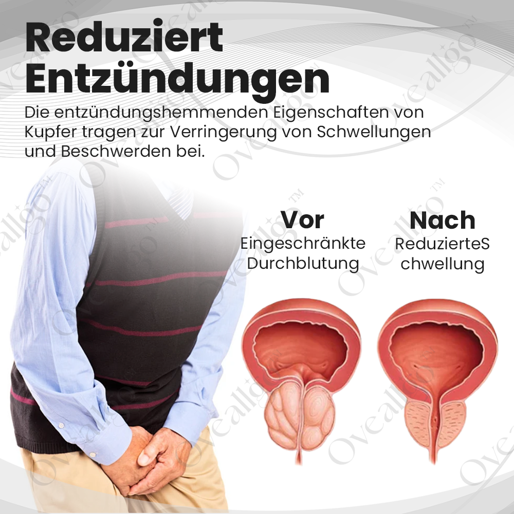 Oveallgo™ KupferMag Prostata-Therapie-Ring