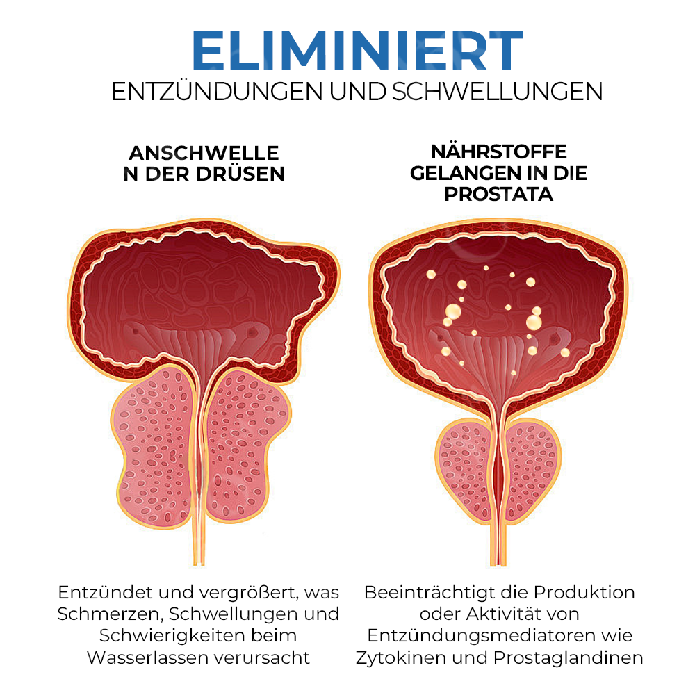 Oveallgo™ BeeBoom BIO-ACTIVE Naseninhalator für die Prostatagesundheit