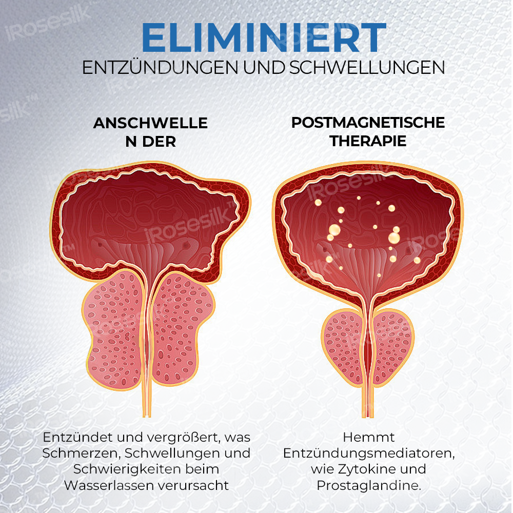 iRosesilk™ MagnaFlow Prostata-Entlastungs-Boxershorts