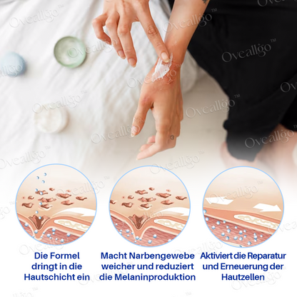 Oveallgo™ SilkScar Narbenbehandlung & Hautreparatur-Serum