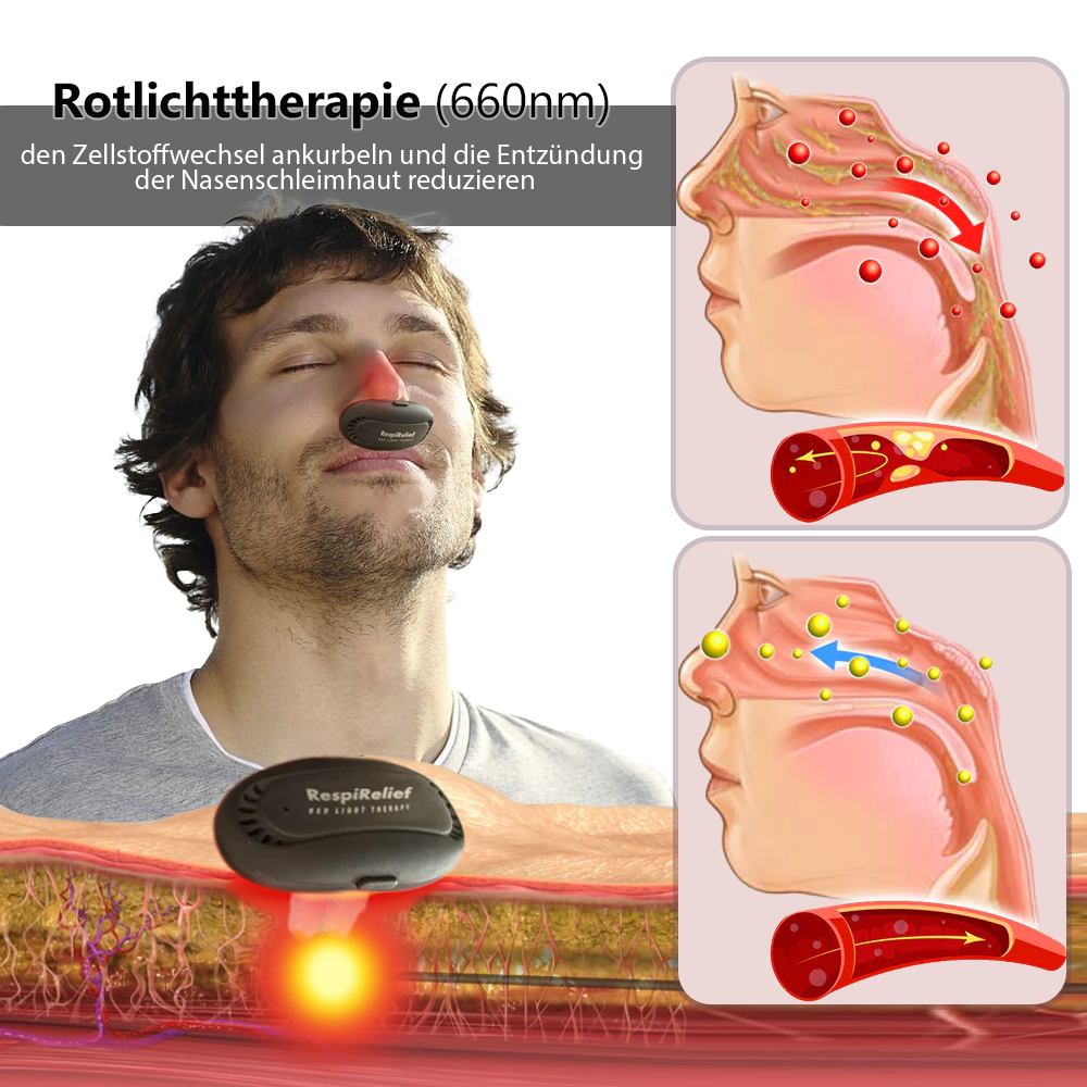 Oveallgo™ INSTANT X RespiRelief Rotlicht Nasaltherapiegerät