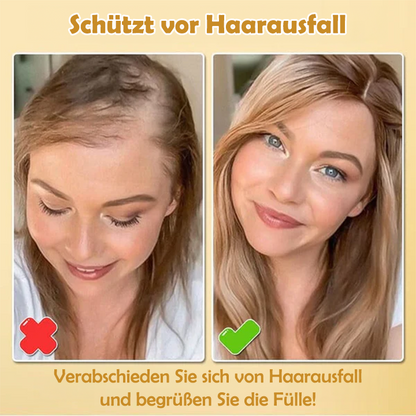 Oveallgo™ Biotin Haarwachstumsessenz-Spray