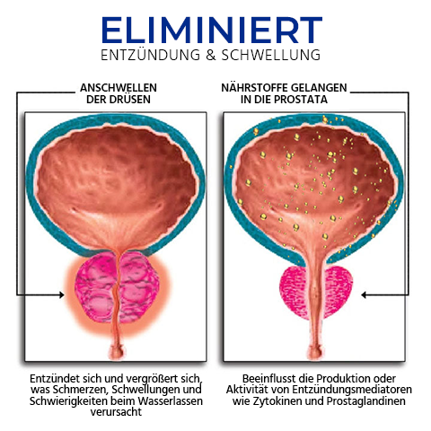 Oveallgo™ BeeProsta ACTIVE Nasenspray für die Prostatagesundheit