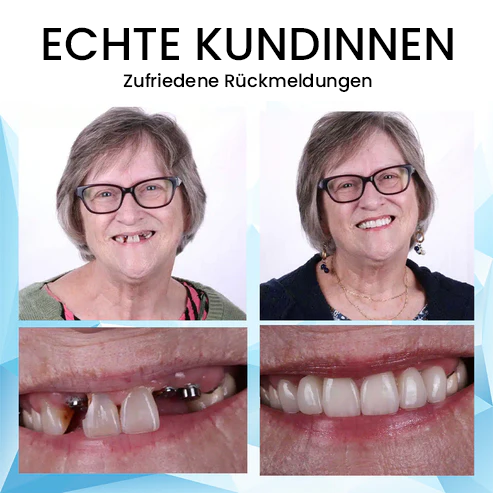 Oveallgo™ Silikon-Reline-Zahnersatz-Set🦷