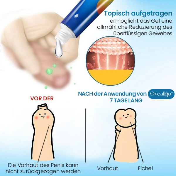 Oveallgo™ Überflüssiges Vorhaut-Korrekturgel