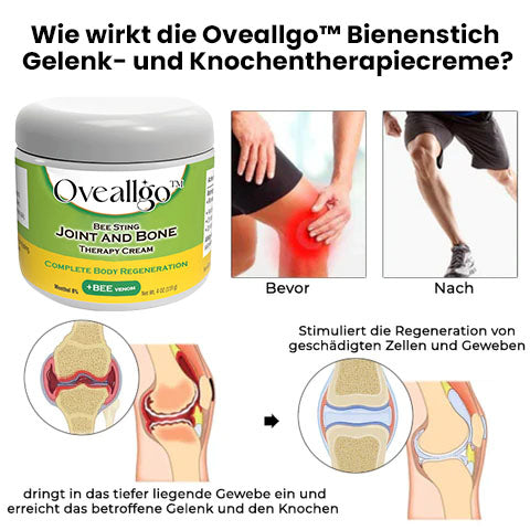 Oveallgo™ Bee Sting X Gelenk - und Knochentherapiecreme – vollständige Körperregeneration