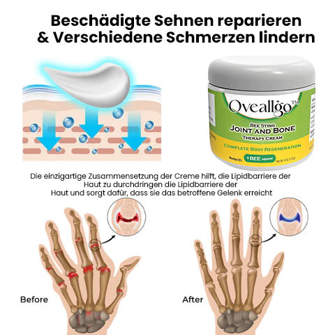 Oveallgo™ Bee Sting X Gelenk - und Knochentherapiecreme – vollständige Körperregeneration