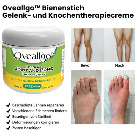 Oveallgo™ Bee Sting X Gelenk - und Knochentherapiecreme – vollständige Körperregeneration