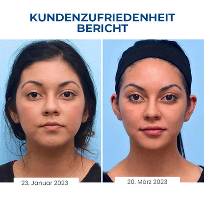 Oveallgo™ SchlafSchönheit Set [Gesichtsformer + Serum zur Straffung der Halshaut ohne Kropf]