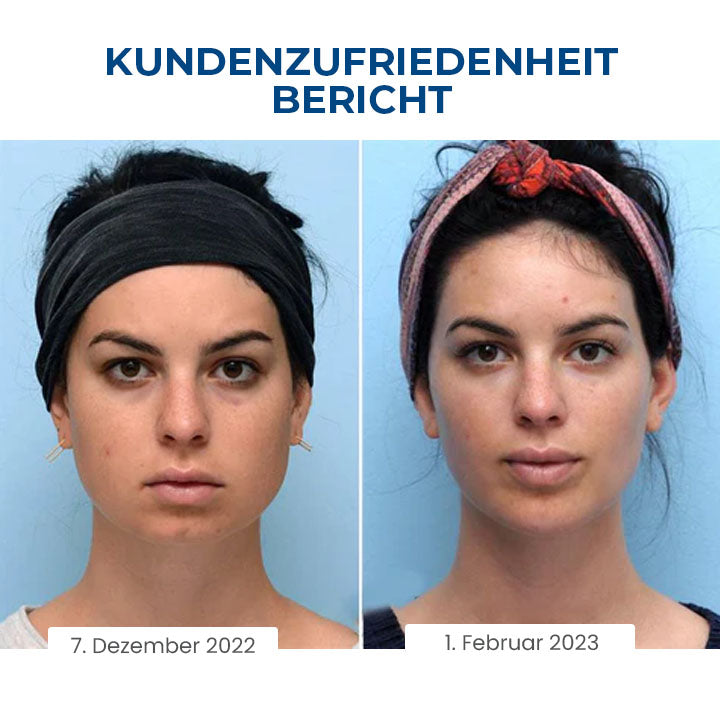 Oveallgo™ SchlafSchönheit Set [Gesichtsformer + Serum zur Straffung der Halshaut ohne Kropf]