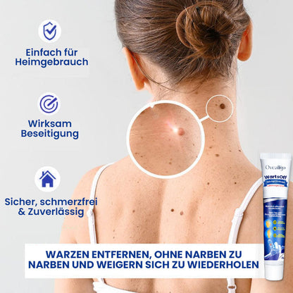 Oveallgo™ Wartsoff Rapid Creme Zur Sofortigen Entfernung Von Hautunreinheiten