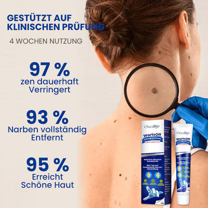 Oveallgo™ Wartsoff Rapid Creme Zur Sofortigen Entfernung Von Hautunreinheiten