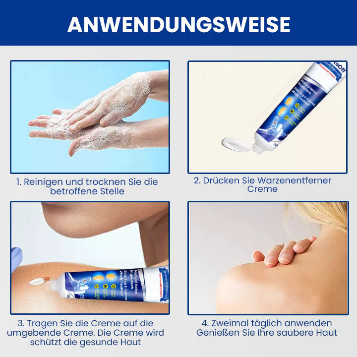 Oveallgo™ Wartsoff Rapid Creme Zur Sofortigen Entfernung Von Hautunreinheiten