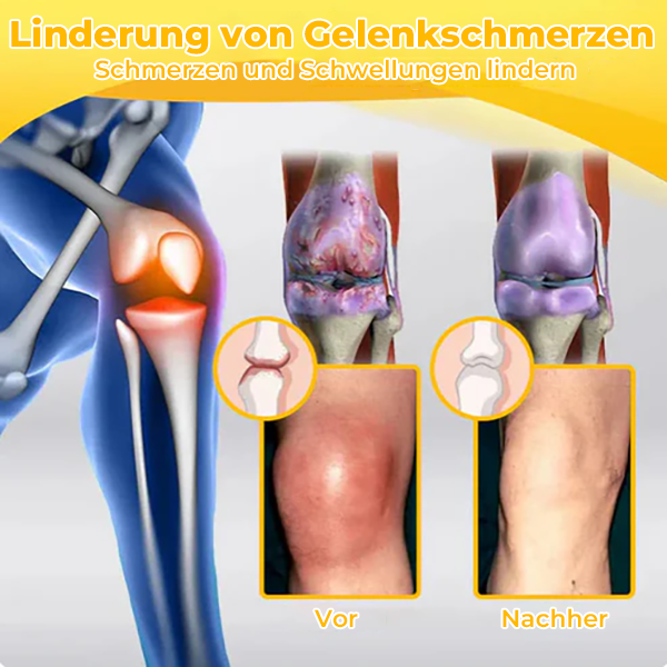 Oveallgo™ Schmerzlindernde Knochenheilungscreme mit Bienengift (Speziell für ältere Erwachsene und von der AOA empfohlen)