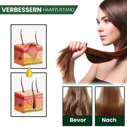 Oveallgo™ Shouga Essence Haarwuchsöl