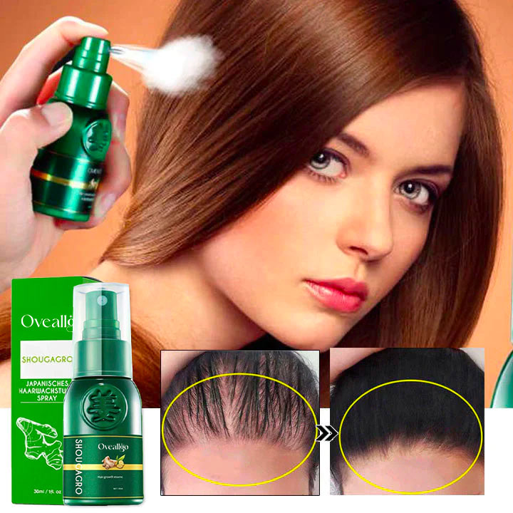 Oveallgo™ ShougaGRO Japanisches Haarwachstumsspray